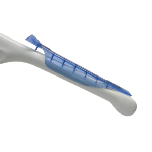 Aspen™ Single-Use Endocavity Needle Guide